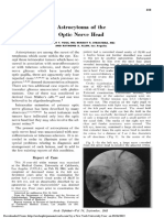 Astrocytoma Optic Nerve Head PDF