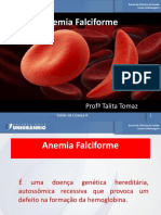 Anemia - Falciforme - e - Leucemia 4