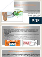 Hipoacusia neurosensorial: causas, síntomas y tratamiento