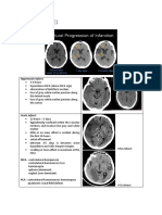 Bleed Vs Infarct Comparison