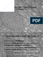 Tiroiditis de Hashimoto