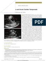 Hemopericardium and Acute Cardiac Tamponade PDF
