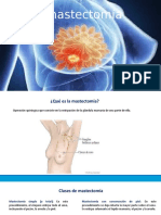 Mastectomia