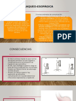 Fístula traqueoesofágica y malformaciones congénitas del tracto gastrointestinal