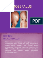penyuluhan_ppt-hidrosefalus[1]