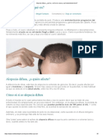 Causas y tratamientos de la alopecia difusa
