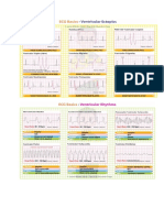 EKG TERBARU PRINT.docx