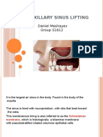 Maxillary Sinus Lifting