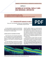 Correlación Anatomía-Oct de Retina, Papila y Capa de Fibras Nerviosas. Artefactos