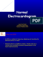 Normal Electrocardiogram: Lucia Kris Dinarti Cardiology Department Faculty of Medicine GMU