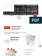 MORTON'S NEUROMA