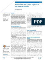 Eyes and Stroke PDF