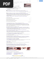 ICD-10 Codes for Styes and Hordeola | PDF | Ophthalmology | Rtt