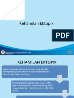 Kehamilan Ektopik