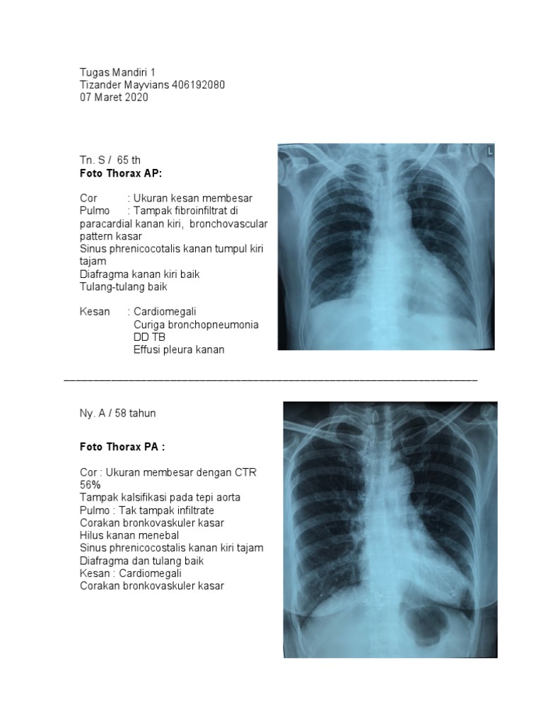 Moyaklar uchun Blowjob texnikasi