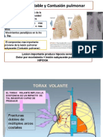 Tórax Inestable y Contusión Pulmonar