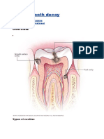 Cavities.docx