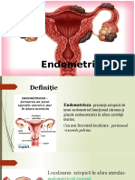 endometriozadkdk.pptx
