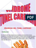 sindrome tunel carpiano