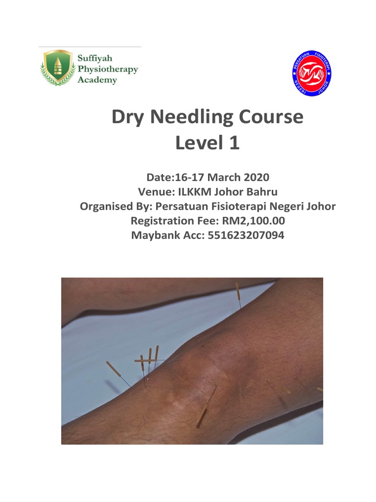 Malaysia Dry Needling Course Flyer 2020 Johor Pdf Physical Therapy Medicine