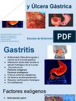 Gastritis y Úlcera Gástrica