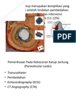 Paravalvular Leack Oclusion Jurnal Reading