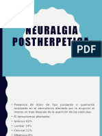 Neuralgia-postherpetica.pptx