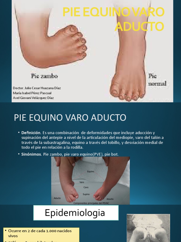 Pie Equino Varo Aducto PDF Pie Enfermedades y trastornos