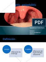 Faringitis - Amigdalitis