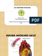 Infark Miokard Akut