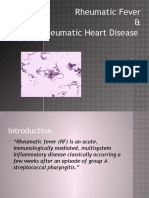 Rheumatic Fever & Heart Disease: Causes, Symptoms, Diagnosis