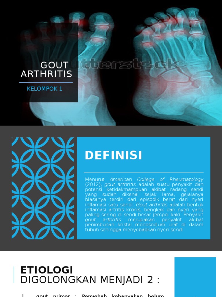Gout Arthritis Fix PDF