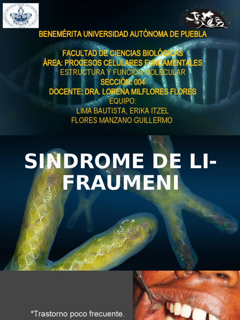 Sindrome de LI FRAUMENI | PDF | P53 | Mutación