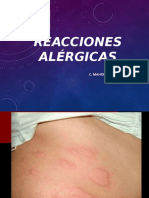 Reacciones Alergicas