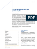 Acromioplastia Quirúrgica