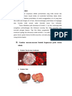 Patofisiologi Neoplasma