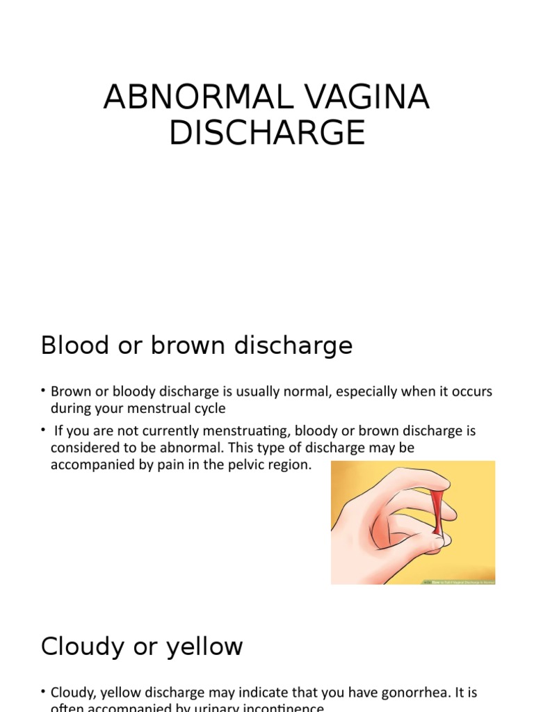 Types of Abnormal Vaginal Discharge | PDF | Cooking, Food & Wine
