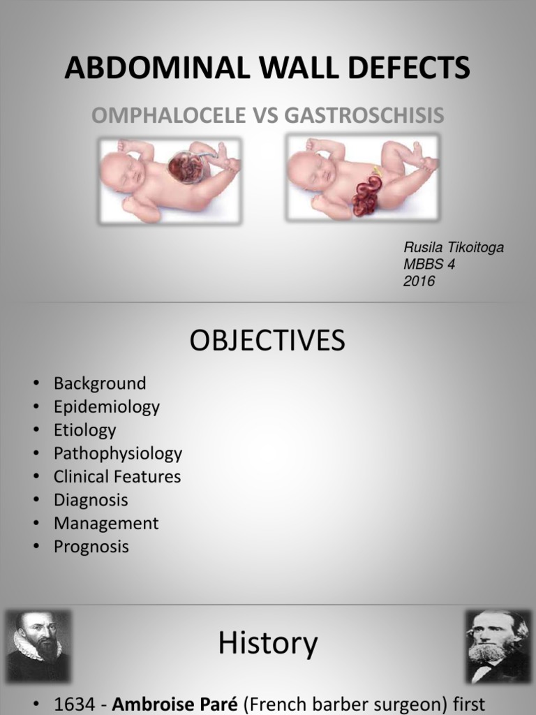 Omphalocele vs Gastroschisis Overview | PDF | Pediatrics | Congenital ...