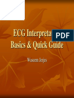 ECG Interpretation ECG Interpretation Basics & Quick Guide PDF