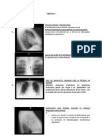 Tarea de Rafdiologia 1