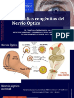 Anomalías Congénitas Del Nervio Óptico