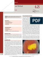 Coats' Disease and Retinal Telangiectasia