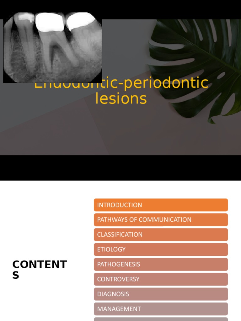 Endoperio lesions Periodontology Human Tooth