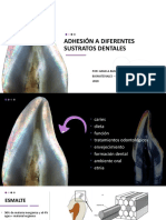 ADHESIÓN A DIFERENTES SUSTRATOS Dentales