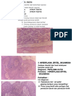 Hiperplasia kelenjar dan epitel kelenjar prostat