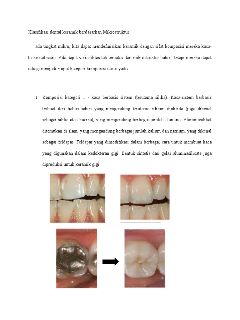 Klasifikasi Dental Keramik PDF