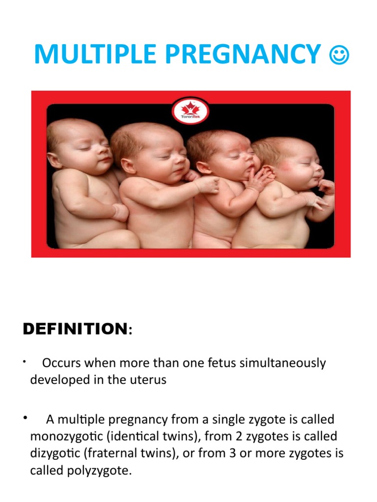 MultiplePregnancy 2 PDF Multiple Births Twin