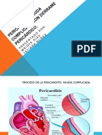 Pericarditis Aguda Complicada Con Derrame Pericárdico