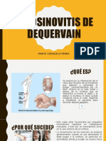 Tenosinovitis de Dequervain Final