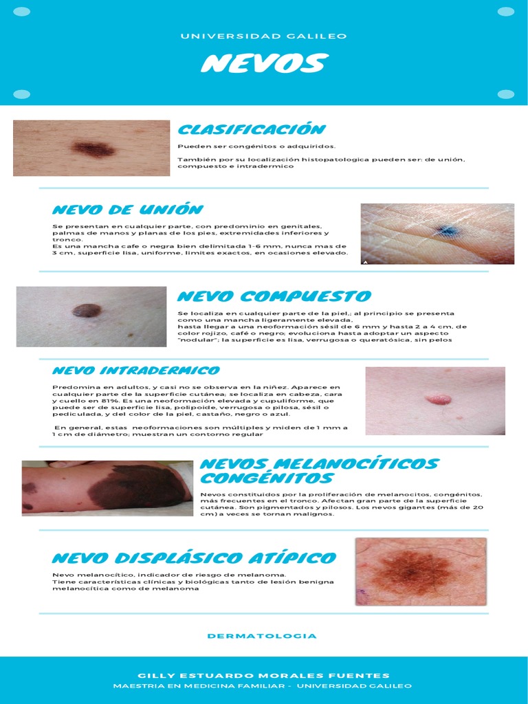 Clasificación de Nevos en Dermatología | PDF | Piel | Enfermedades y  trastornos, image size:768x1024